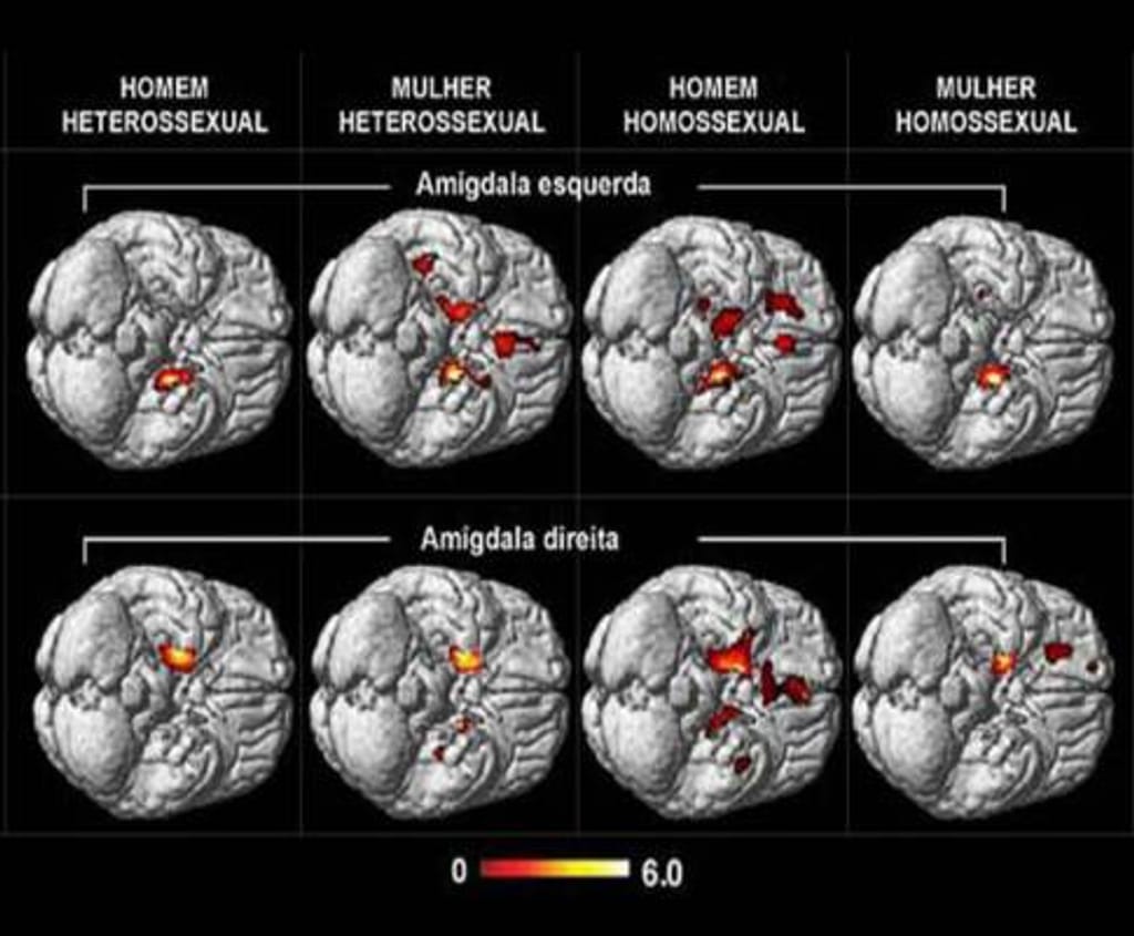 Estudo do cérebro (imagem: PNAS)