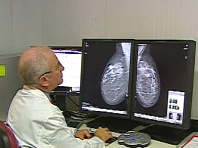 Estudo revela cancros que roubam mais anos de vida saudável - TVI