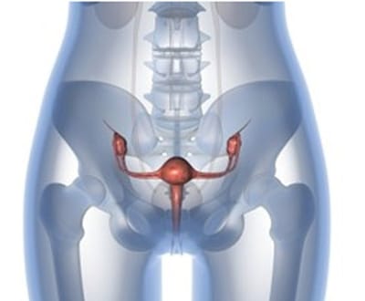 Teste com vinagre pode evitar 73.000 mortes/ano de cancro uterino - TVI
