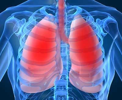 Cancros do aparelho respiratório matam 3600 portugueses por ano - TVI