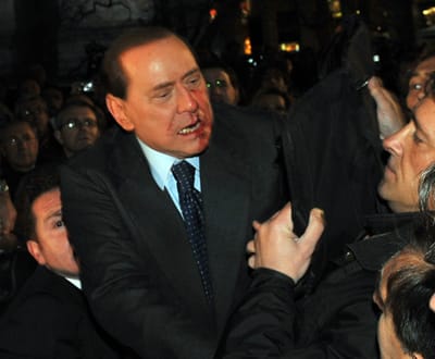 «Foi um milagre não ter perdido o olho», diz Berlusconi - TVI