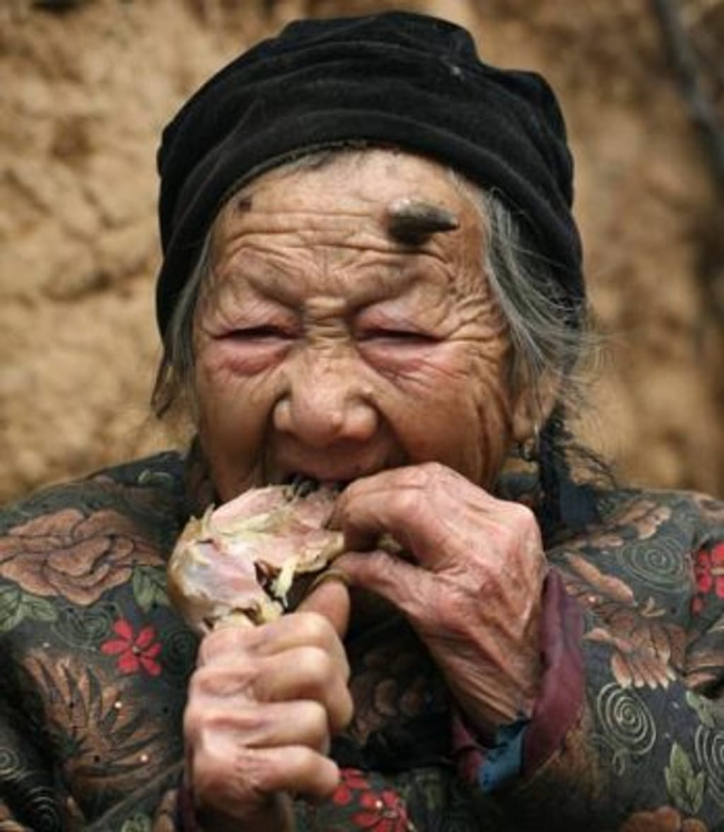 Chinesa de 101 anos desenvolve corno na testa