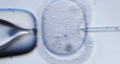 Ninguém sabe o que fazer a milhares de amostras de espermatozoides - TVI