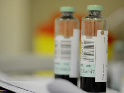 Mais hospitais juntam-se à luta na justiça por tratamento para hepatite C - TVI