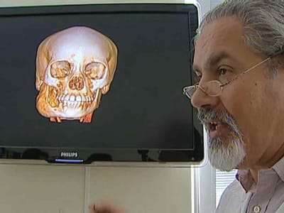 Cirurgia inédita realizada em Portugal - TVI