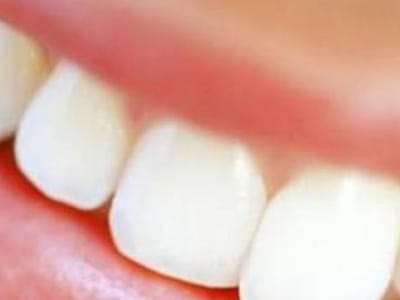 Clínicas Dental Group continuam a funcionar - TVI