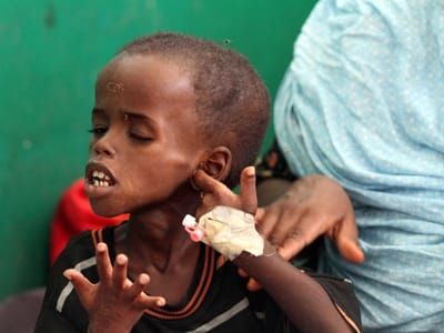 Fome mata quase 30 mil crianças na Somália - TVI