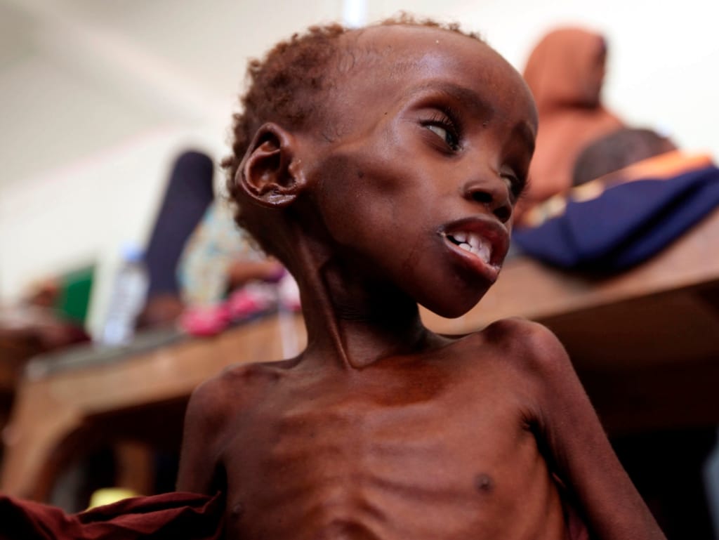 Fome na Somália [Reuters]