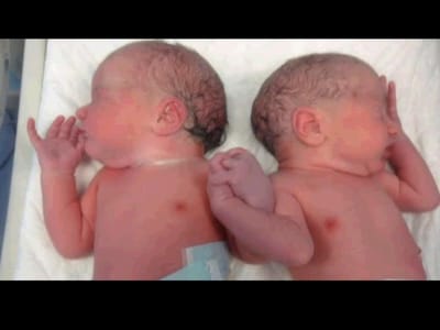 Foto de gémeos recém-nascidos a dar a mão torna-se viral - TVI