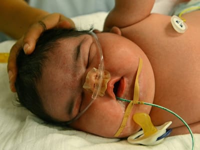 Esta bebé nasceu com mais de seis quilos - TVI