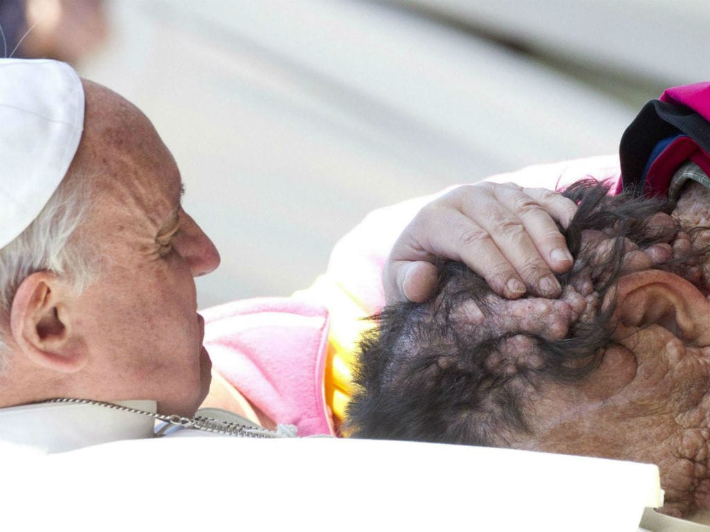 Papa abraça homem desfigurado (EPA/CLAUDIO PERI)