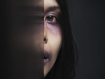 Uma em cada três mulheres é vítima de abusos físicos - TVI