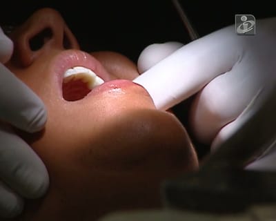 «Irregularidades» encerram clínica da Faculdade de Medicina Dentária - TVI