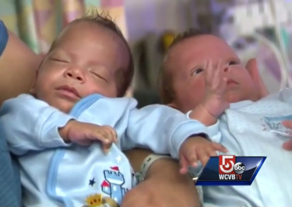 Gémeos nascem com 24 dias de diferença (Reprodução YouTube)