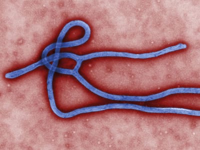 Menina de 2 anos é o primeiro caso de Ébola no Mali - TVI