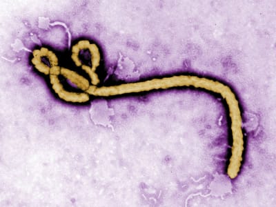 Ébola: médico serra-leonês infetado transportado para os EUA - TVI