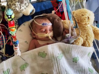 Facebook rejeita foto «demasiado gráfica» de bebé doente - TVI