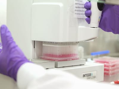 Portugal é o primeiro país a receber avaliação ao plano do ébola - TVI