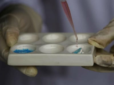 Português lidera novo avanço na vacina contra a sida - TVI