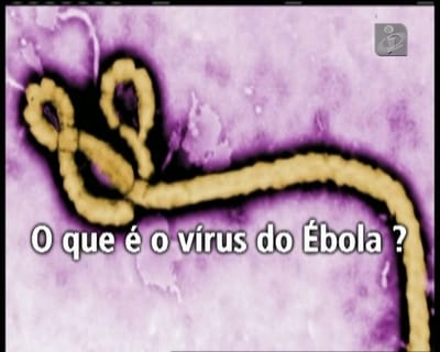 Tudo o que precisa saber sobre o Ébola - TVI