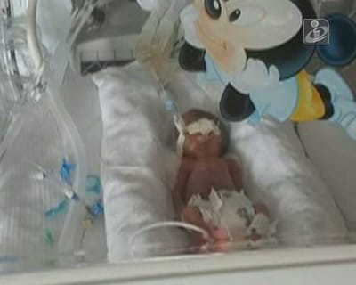 Dubai: bebé prematura vai ser transferida para hospital público - TVI