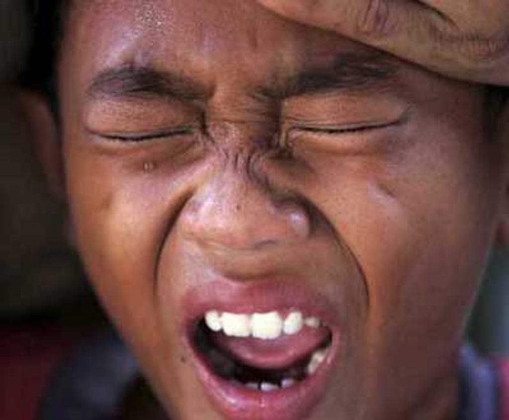 Criança ferida no sismo da Indonésia - Foto Lusa
