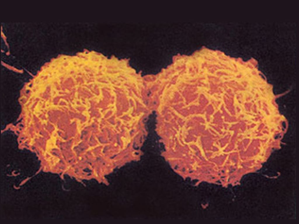 Células cancerígenas