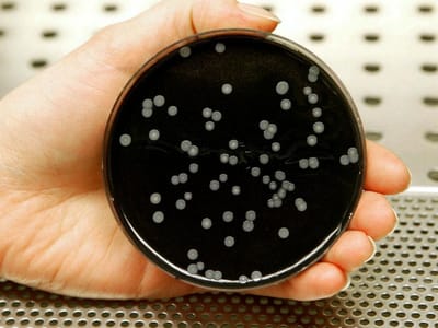Legionella: há já 90 pessoas infetadas - TVI