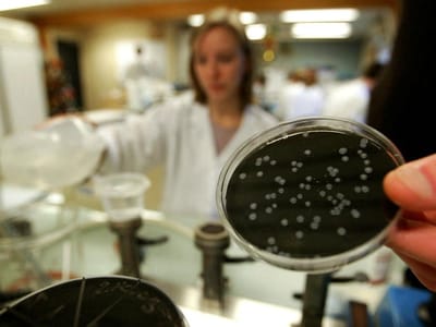 Legionella: utilizar água de furos tem riscos quase «nulos» - TVI