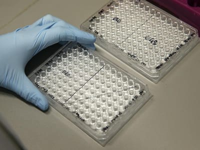 Descobertos anticorpos humanos contra todas as estirpes do Ébola - TVI