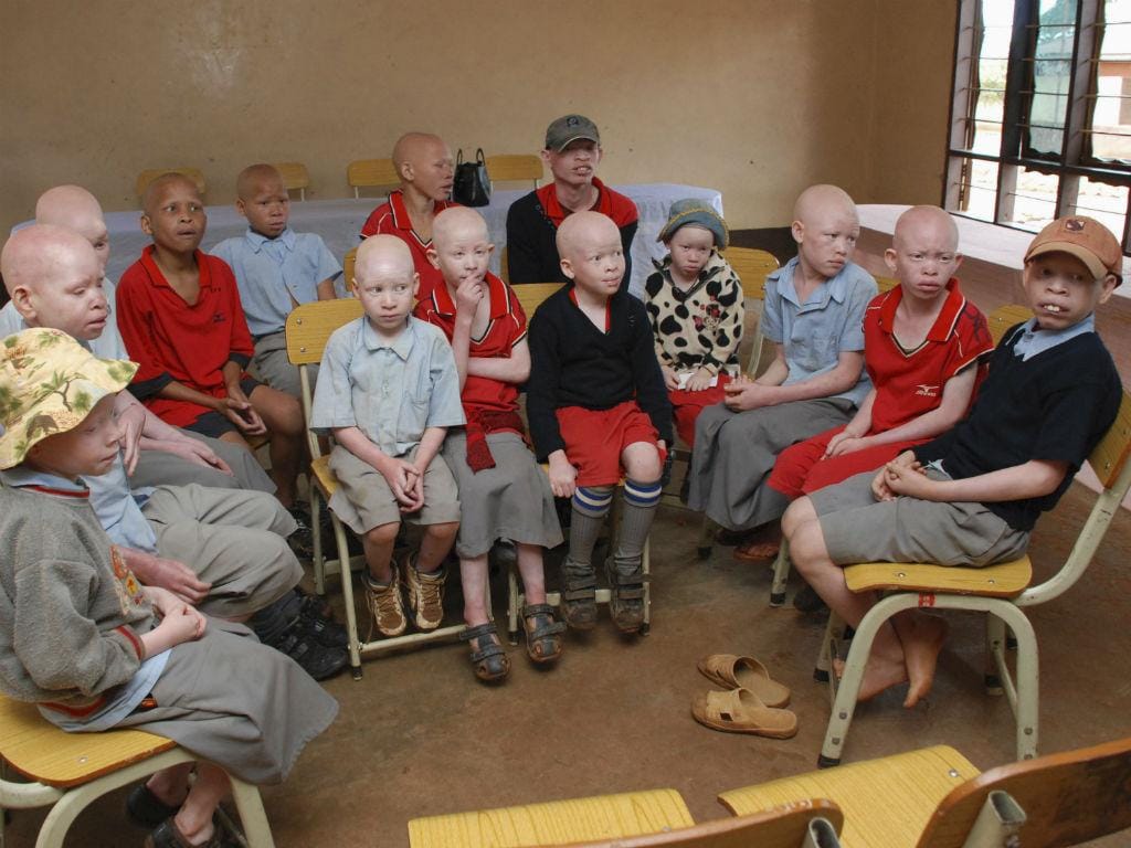 Albinos na Tanzânia [Foto: Reuters]