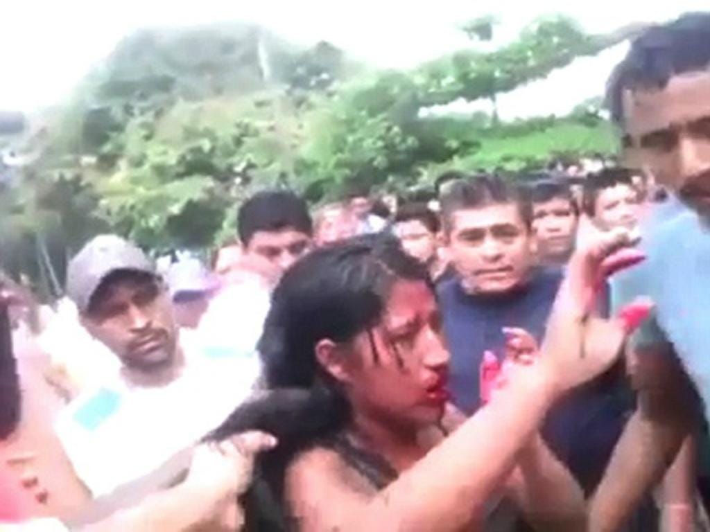 Rapariga queimada viva na Guatemala [Youtube]