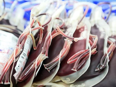 Instituto de Sangue pede dádivas dos tipos 0- e A- - TVI
