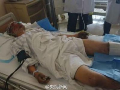 Bombeiro resgatado 36 horas após explosões na China - TVI