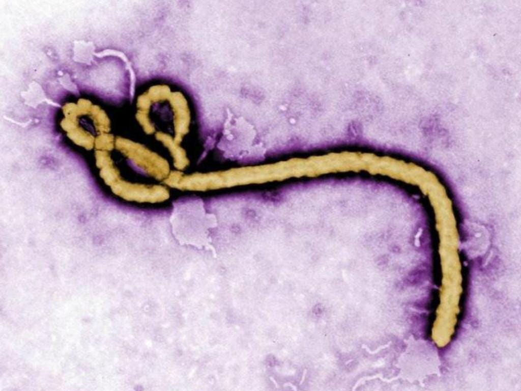 Ébola (Foto Reuters)