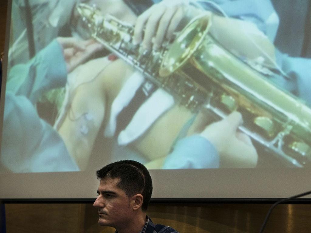 Paciente toca saxofone durante operação ao cérebro