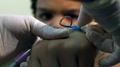 OMS duplica período de sexo seguro após viagem a zonas afetadas pelo Zika - TVI