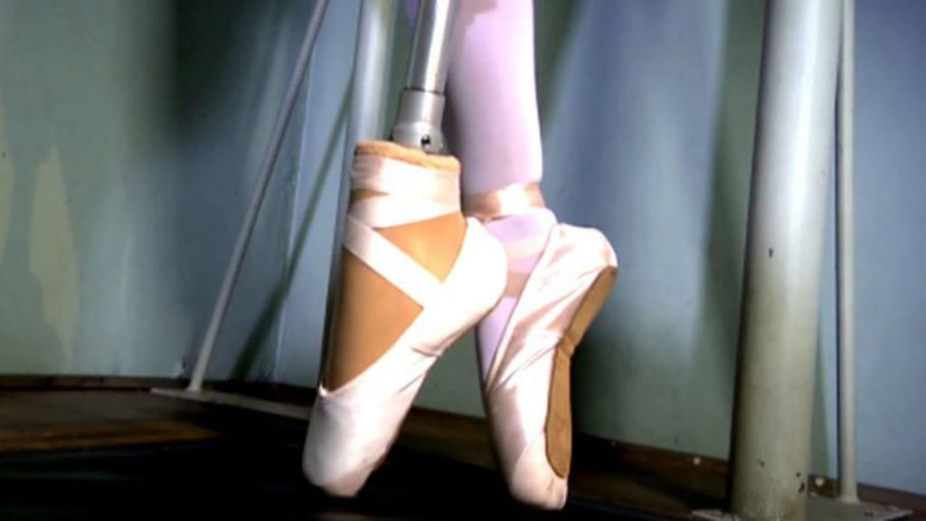Bailarina amputada volta a dançar graças a prótese inovadora