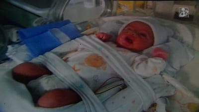 "Bebé milagre" já teve alta hospitalar - TVI