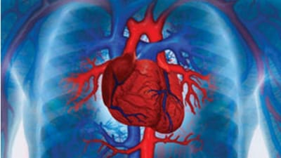 Doentes cardiovasculares não mudam comportamentos após AVC ou enfarte - TVI