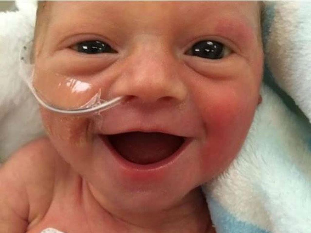 Bebé prematura sorri ao quinto dia de vida