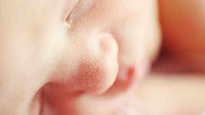 Onze bebés morreram porque as mães tomaram viagra na gravidez - TVI