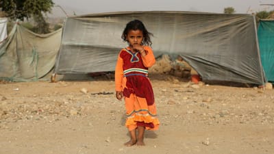 Iémen: mais de um milhão de crianças em risco de contrair cólera - TVI