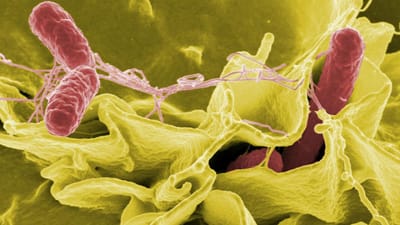 Superbactérias de hoje têm raízes há centenas de milhões de anos - TVI