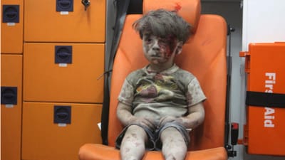 Veja como está Omran, a criança que se tornou um símbolo da guerra na Síria - TVI