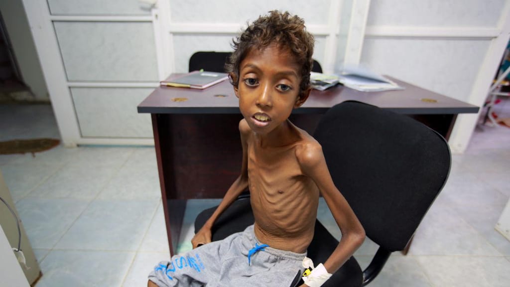 Símbolos da fome no Iémen 