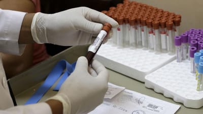 Novo teste de sangue consegue detetar vários tipos de cancro - TVI