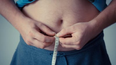 Obesidade dificulta combate ao cancro - TVI