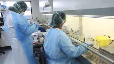 Estados Unidos financiam estudo português sobre Doença Inflamatória Intestinal - TVI