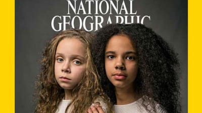 Uma branca e outra negra: história das gémeas que são capa da National Geographic - TVI